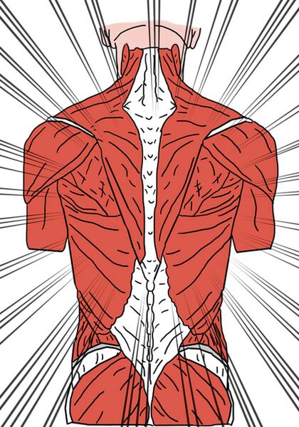 Datei:Rücken Muskeln Wirbelsäule Rückenschmerz.jpg