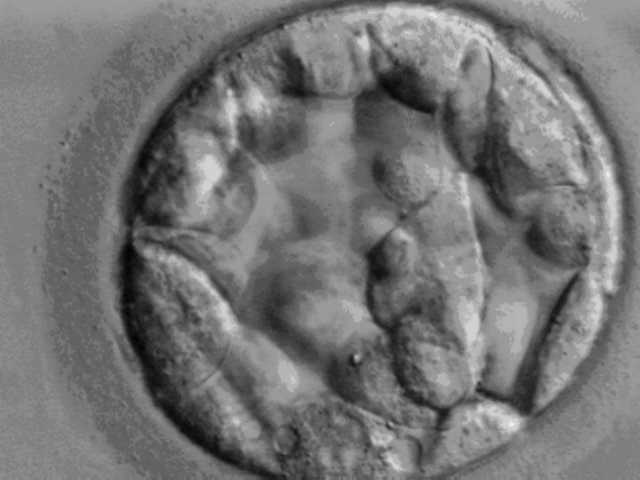 Datei:Embryo Garbha Mensch Blastocyst.JPG
