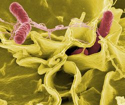 Salmonellen Bakterien Viren Parasiten Mikroben.jpg