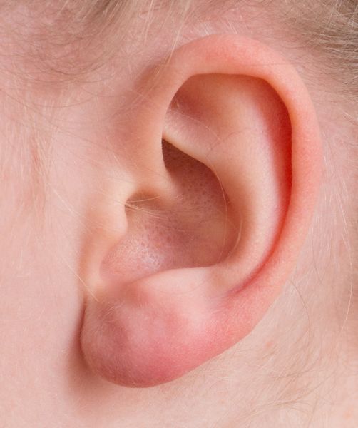 Datei:Ear-Akupunktur-Nadel.jpg
