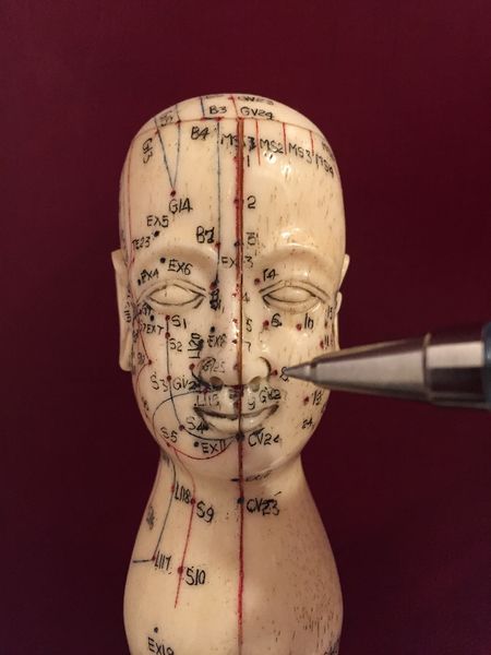 Datei:Akupunktur Kopf Gesicht.jpg