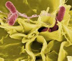 Salmonella Salmonellen Bakterien Viren Krankheit Virus.jpg